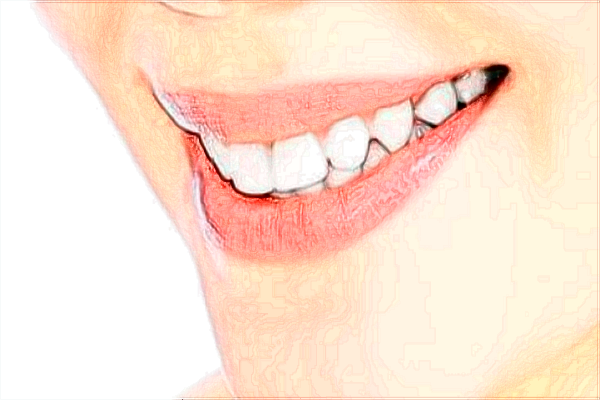 北京天壇醫(yī)院補牙價目表(價格表)怎么樣