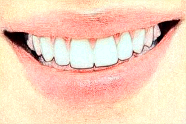 北京天壇醫(yī)院種植牙怎么樣_哪位醫(yī)生做的比較好