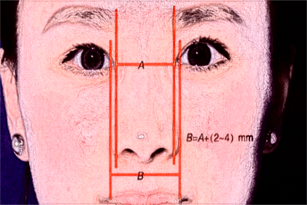2024廣州海峽脂肪填充價(jià)格表(價(jià)目表)一覽
