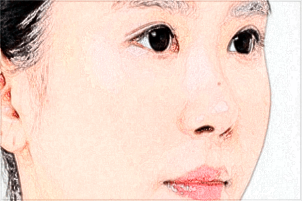 長沙梵童醫(yī)院熱瑪吉價格表?熱瑪吉功效與副作用