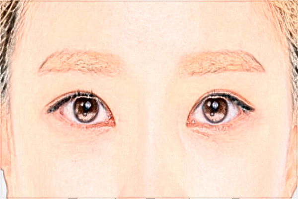 2024填淚溝價格表_交大二院填淚溝怎么樣