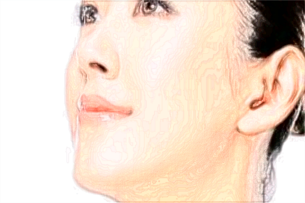 北京天壇醫(yī)院打除皺怎么樣_打注意事項(xiàng)有哪些