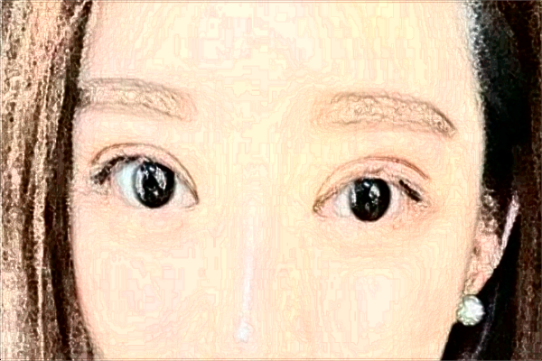 北京藝美脂肪隆鼻價(jià)目表(價(jià)格表)怎么樣