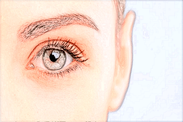 浙江醫(yī)院去黑眼圈怎么樣?2024激光去黑眼圈價格?