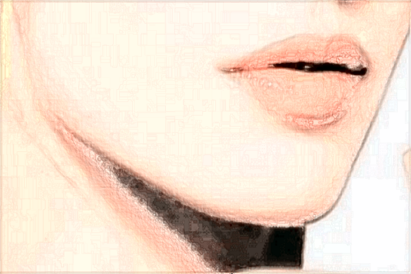 浙江醫(yī)院正頜價格怎么樣?正頜手術風險大嗎