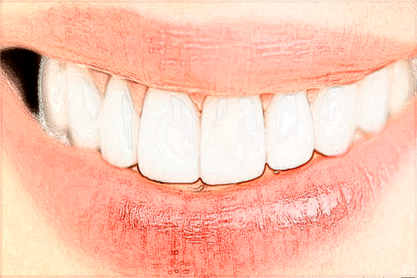 2024種牙多少錢一顆?植牙和種牙的區(qū)別