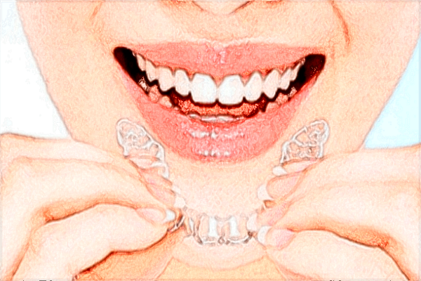 2024重慶解放軍324醫(yī)院口腔科牙齒美白怎么樣_牙齒美白對牙齒有傷害嗎