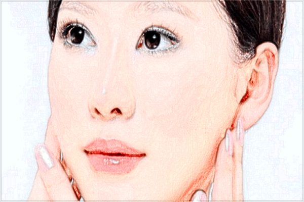 上海時光整形醫(yī)院去紅血絲怎么樣【附激光去紅血絲案例】