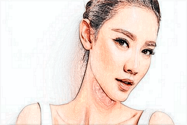 上海時光整形醫(yī)院去紅血絲怎么樣【附激光去紅血絲案例】