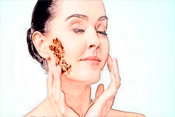 2024鑲牙價格費用?鑲牙要多久時間