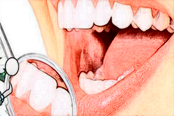 北京大學(xué)第三醫(yī)院口腔科怎么樣?牙齒矯正好不好