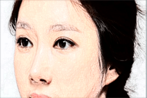 光子嫩膚價(jià)格一覽表?光子嫩膚祛斑怎么樣