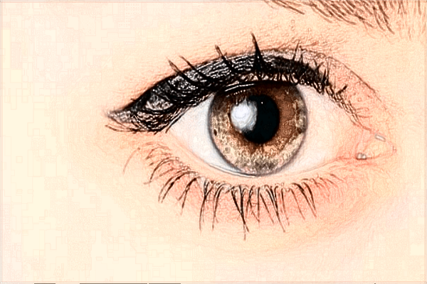 激光近視手術(shù)價(jià)格2024?激光近視手術(shù)的后遺癥有哪些