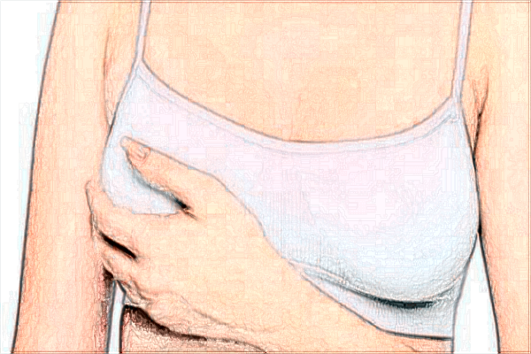 隆胸假體費用2024?隆胸假體可以放多久?