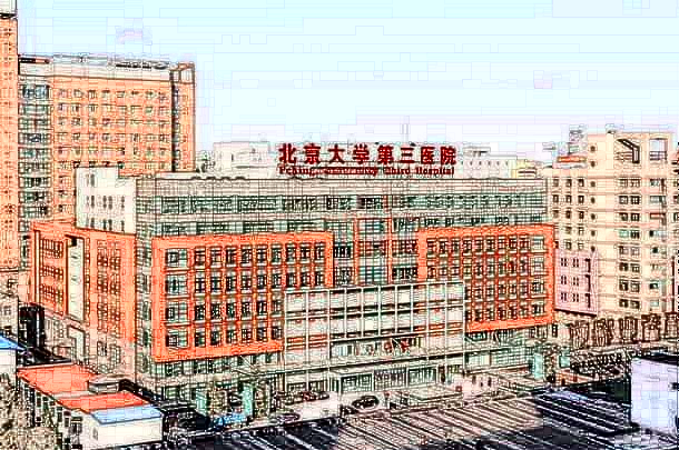 2024北京大學(xué)第三醫(yī)院光子嫩膚價(jià)格表怎么樣