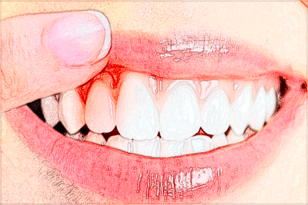 北大醫(yī)院口腔科牙齒美白價(jià)目表(價(jià)格表)怎么樣