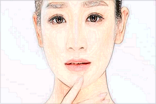 玻尿酸豐面頰會腫嗎?玻尿酸豐面頰會移位嗎?