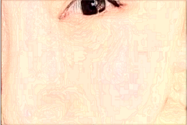 北京潤美玉之光激光祛斑哪個醫(yī)生好_2024激光祛斑價格表