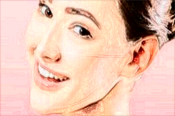 2024-2024交大二院拉皮除皺怎么樣_拉皮除皺手術(shù)能保持多少年