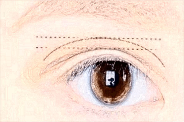 北京二院2024做雙眼皮價(jià)格?做雙眼皮哪個(gè)醫(yī)生好