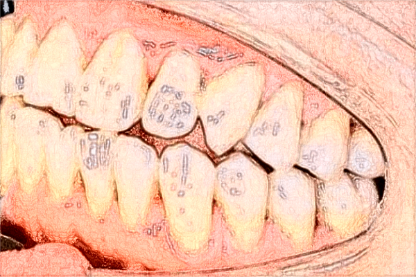 馬鞍山市人民醫(yī)院口腔科怎么樣?2024口腔科矯正價格
