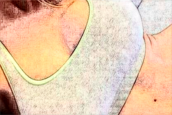 貴陽中醫(yī)學院二附院脂肪填充怎么樣_醫(yī)生技術怎么樣