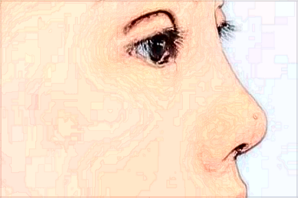 成都雍和華仁怎么樣?是正規(guī)的嗎?附整形項目表