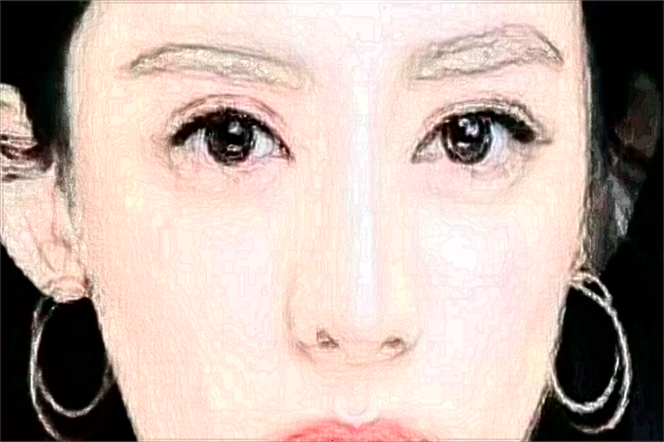 北京潤(rùn)美玉之光去眼袋怎么樣_哪位醫(yī)生技術(shù)好