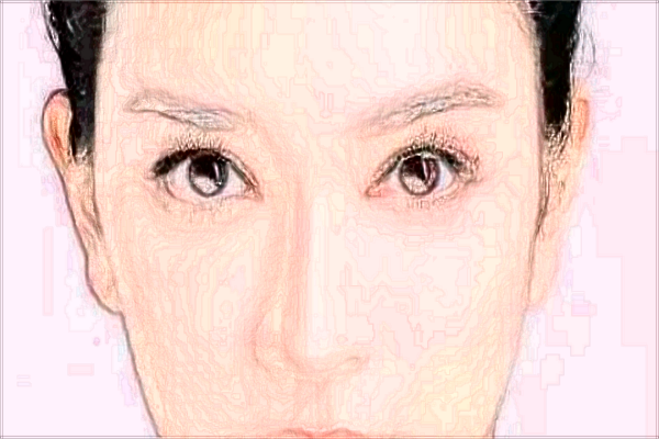 北京潤(rùn)美玉之光去眼袋怎么樣_哪位醫(yī)生技術(shù)好