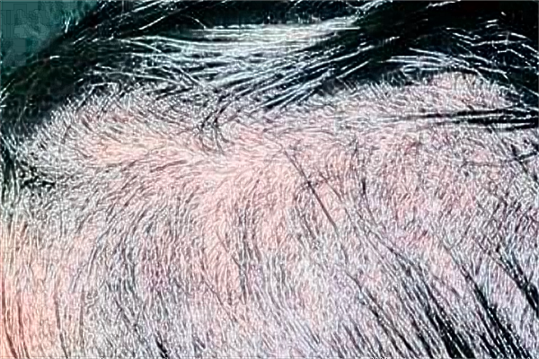 常熟二院植發(fā)好不好?2024植發(fā)價(jià)格表