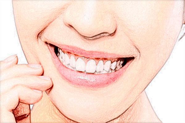 北京大學(xué)口腔醫(yī)院種植牙價格表_種植牙需要住院嗎