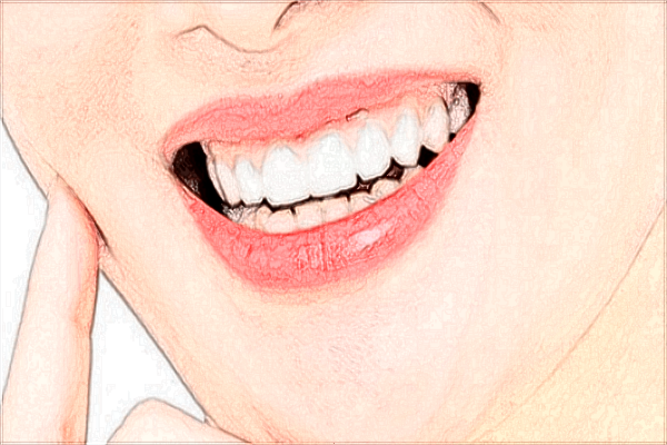 北京大學(xué)口腔醫(yī)院種植牙價格表_種植牙需要住院嗎