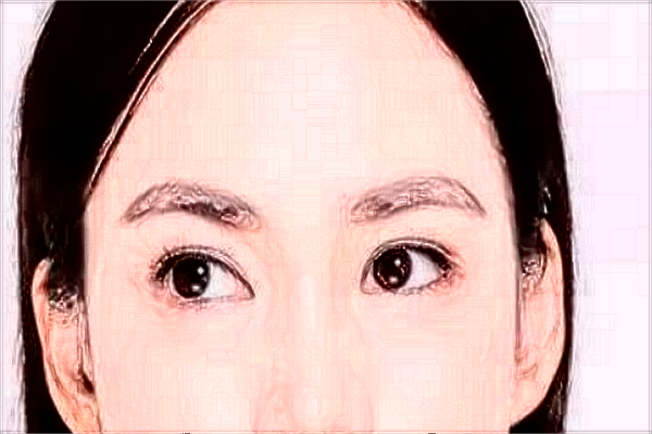 2024廣州華美哪個醫(yī)生比較好【附案例】