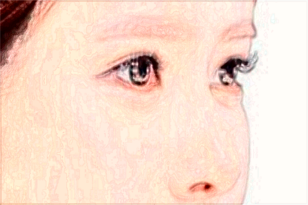 2024隆鼻價格表公布_交大二院隆鼻技術(shù)怎么樣