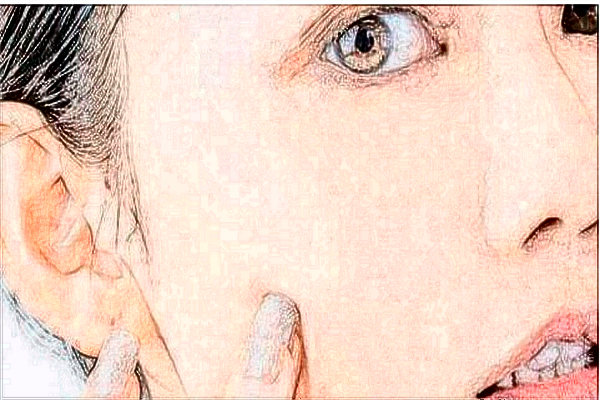 玻尿酸豐面頰疼嗎?玻尿酸豐面頰靠譜嗎?