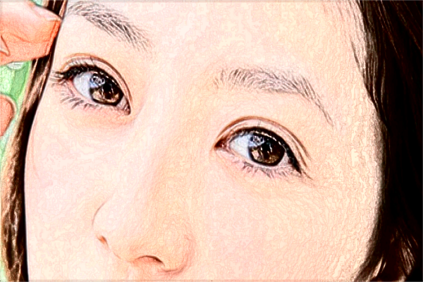 玻尿酸豐面頰打一次合適嗎?玻尿酸豐面頰會(huì)發(fā)炎嗎?