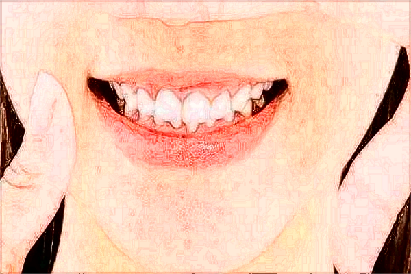 廣州華美牙科怎么樣_附醫(yī)生名單推薦