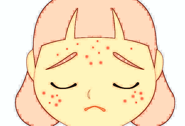 北京美萊祛斑怎么樣?祛斑后多久恢復(fù)正常皮膚