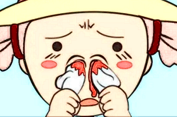 膨體隆鼻多少費用?膨體隆鼻要忌口多長時間?