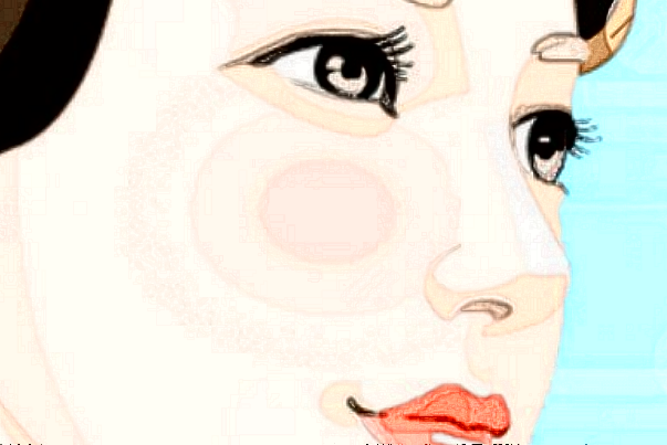 膨體隆鼻自然嗎?膨體隆鼻不滿意多久可以取出?