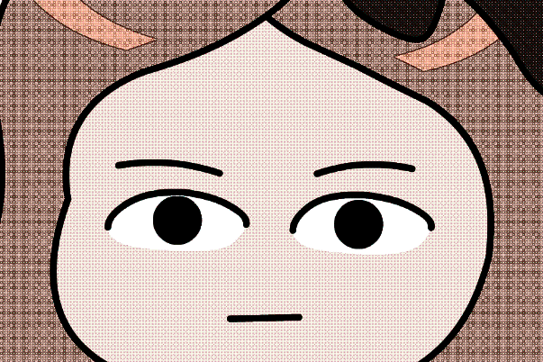 2024-2024南京市中醫(yī)院割雙眼皮的案例_大概需要多少錢(qián)