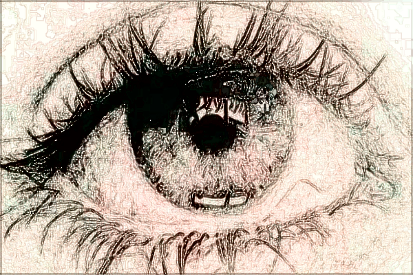 2024四川省人民醫(yī)院割雙眼皮怎么樣【雙眼皮案例】