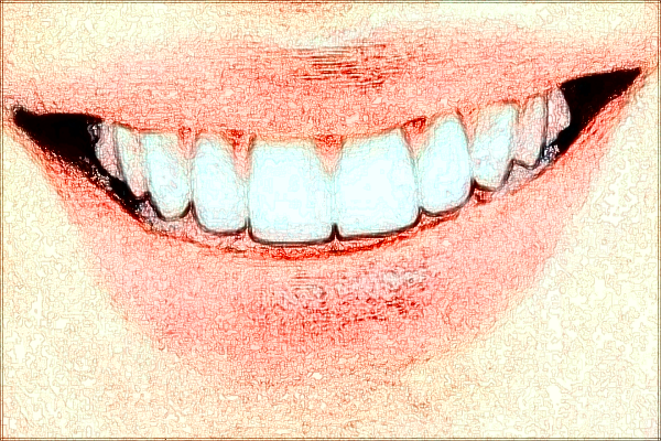 四川省人民醫(yī)院種牙多少錢_種牙和鑲牙區(qū)別在哪里