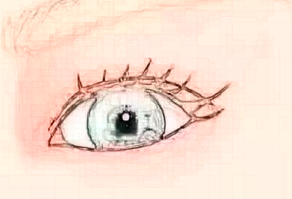 寧波二院去眼袋怎么樣?寧波二院去眼袋收費價格