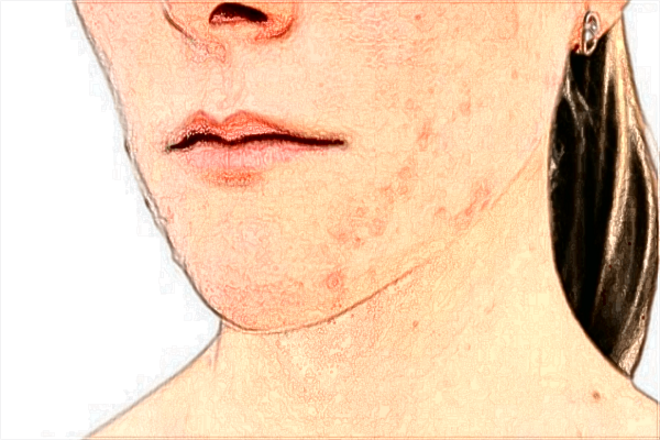 2024威海市立二院豐下巴價格_玻尿酸豐下巴注意事項