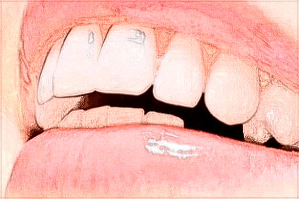 福州市第二醫(yī)院牙科怎么樣?2024牙齒矯正價(jià)格一覽