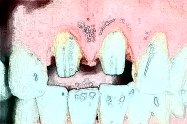 福州市第二醫(yī)院牙科怎么樣?2024牙齒矯正價(jià)格一覽