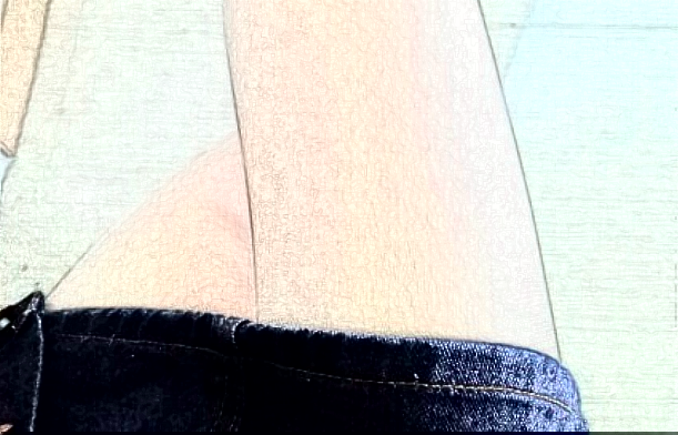 成都格萊麗抽脂做的好不好?大腿抽脂收費(fèi)價(jià)格表2024