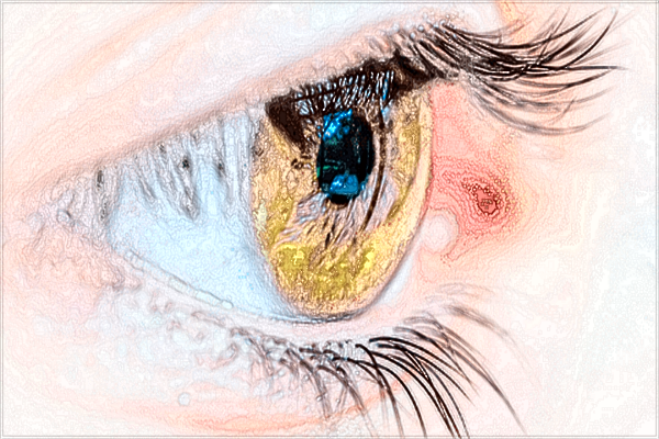 2024成都格萊麗做雙眼皮價格?醫(yī)生雙眼皮案例