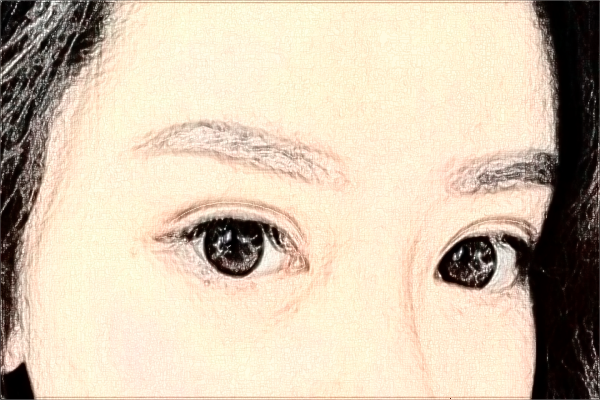 上海華山醫(yī)院玻尿酸除皺需要多少費(fèi)用|怎么樣